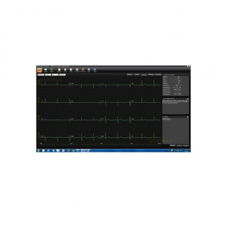 SE-1515 trådløs PC-EKG DX12, EDAN