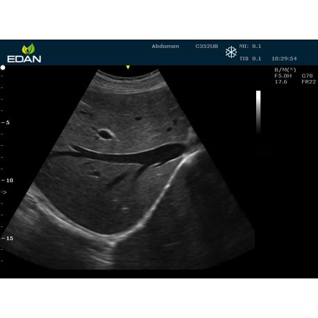 DUS 60 Ultrasound Scanner