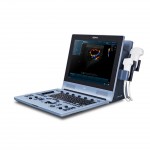 U60 Edan Ultrasonic Scanner with color Doppler