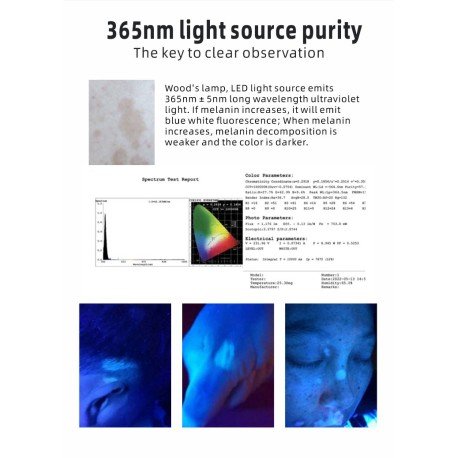 Woods lamp, professional UV inspection light, 16 LED, rechargeable
