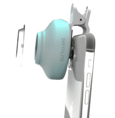 DermLite HÜD, dermatoscope.