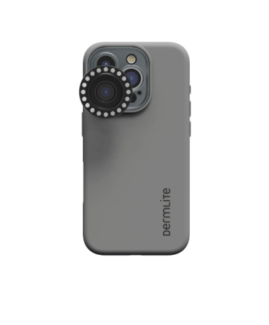 Iphone 17 PRO adaptor, Dermlite