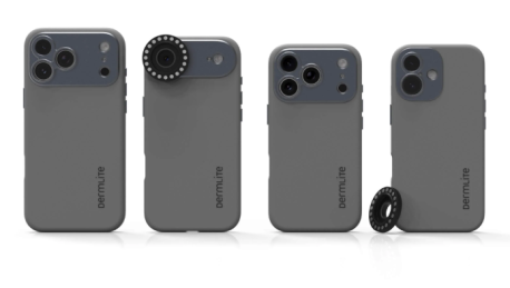 iPhone 17 Pro adapter, DermLite