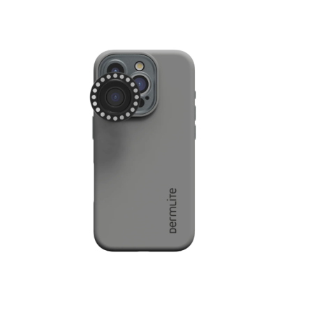 Iphone 16 adaptor, Dermlite