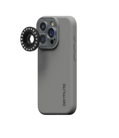 iPhone 16 adapter, Dermlite